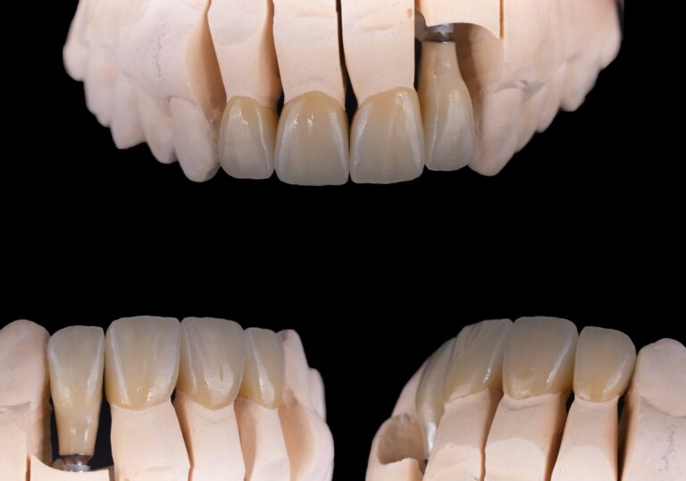 Cyrkon licowany ceramika