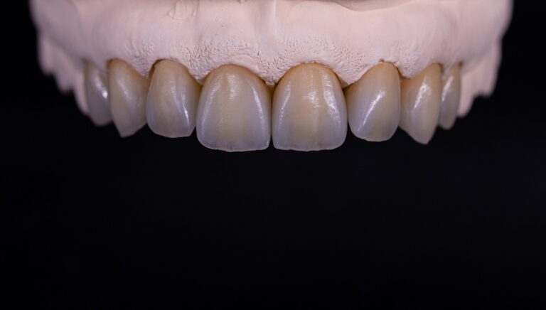 Korony licowane ceramika 