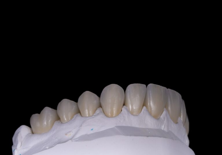 Korony licowane ceramika